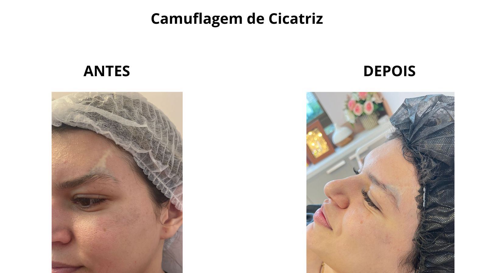 inserir um subtítulo